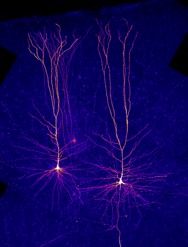 neurons of 2/3layer of human neo-cortex