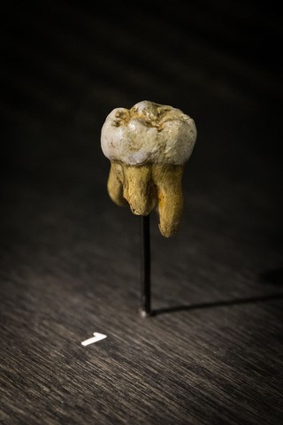 molar, denisovan