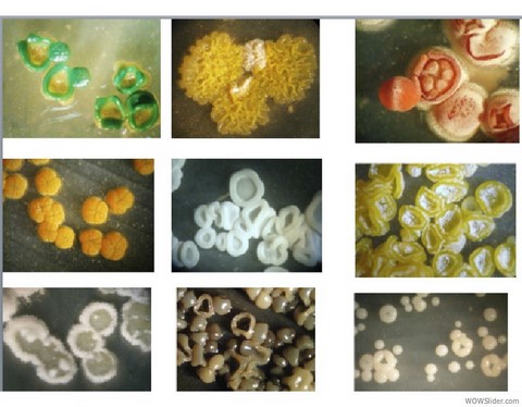 colonies of actinomycetes